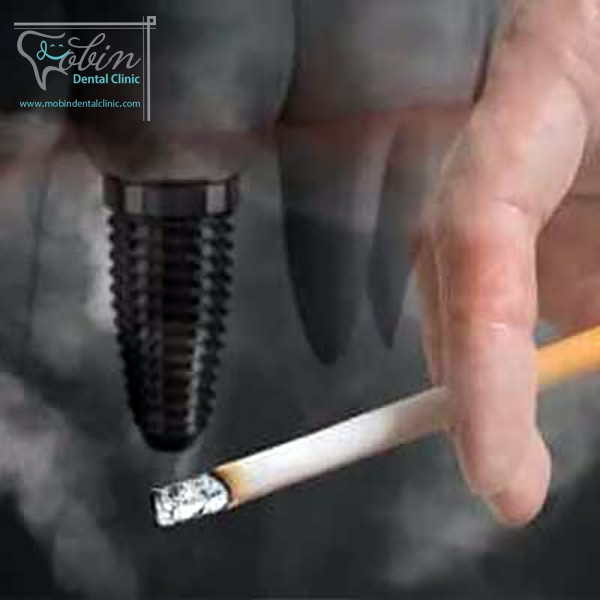 مشکلات ایمپلنت برای افراد سیگاری